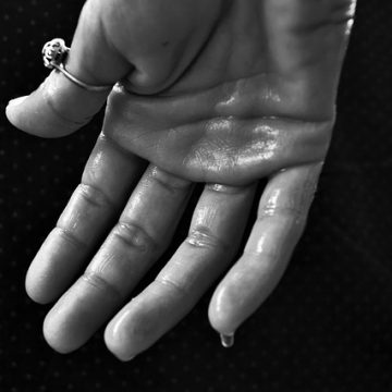 ללא חשש נגיעה: הזעת יתר – יש פיתרון הומאופתי